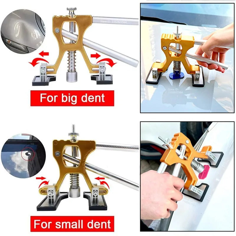 DentFix™ Pro - Professional Gold Series Car Dent Repair Kit