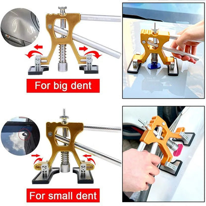 DentFix™ Pro - Professional Gold Series Car Dent Repair Kit