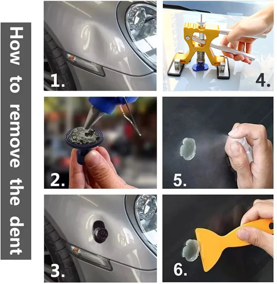 DentFix™ Pro - Professional Gold Series Car Dent Repair Kit
